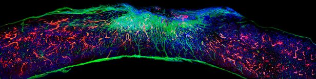 초분자 섬유 겔을 주입하고 12주가 지난 뒤 생쥐 척수의 종단면. 손상 부위 안에서 혈관(붉은색)이 재생했다. 신경세포는 파란색, 세포외기질을 구성하는 라미닌은 녹색으로 염색됐다./미 노스웨스턴대